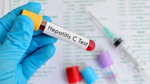 Hepatitis virales