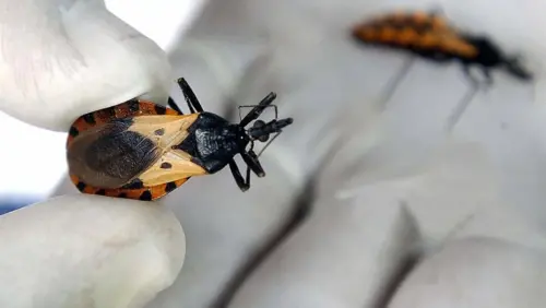 Chagas